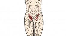 Illustration af lymfesystemet i en menneskekrop